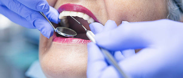 Best Emergency Root Canal Treatment in Blowing Rock, NC